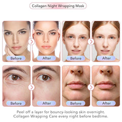 Medicube Bio Collagen Face Mask Overnight, Bio Collagen Face Mask, Bio Collagen Mask, Hydrating Overnight Hydrogel Mask, Pore Minimizing, Elasticity (Pack Of 1, TUBE 75 gm)