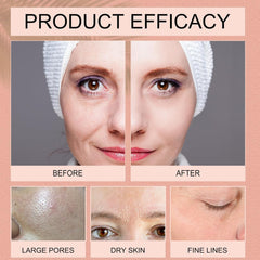Medicube Bio Collagen Face Mask Overnight, Bio Collagen Face Mask, Bio Collagen Mask, Hydrating Overnight Hydrogel Mask, Pore Minimizing, Elasticity (Pack Of 1, TUBE 75 gm)