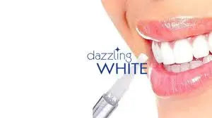 TEETH WHITENING PEN Clari
