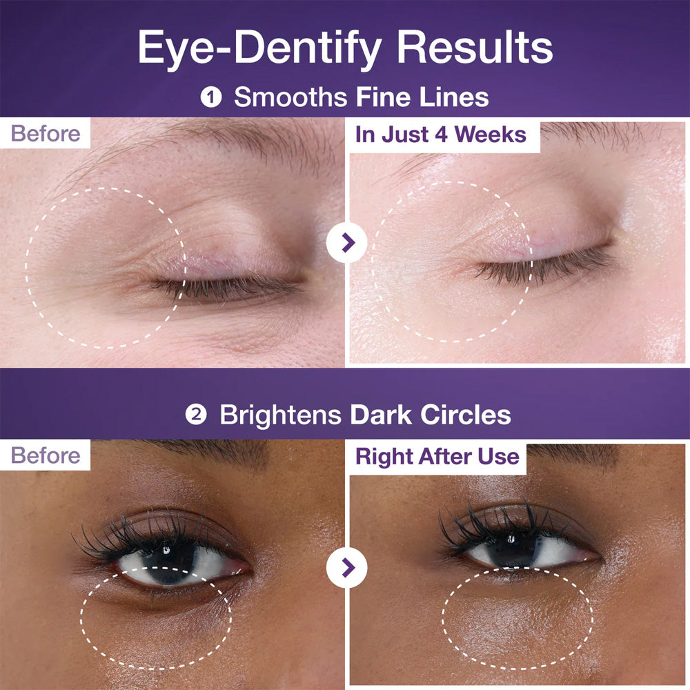 Numbuzin – No.9 NAD+ Retinol Volumetox Eye Cream 10ml