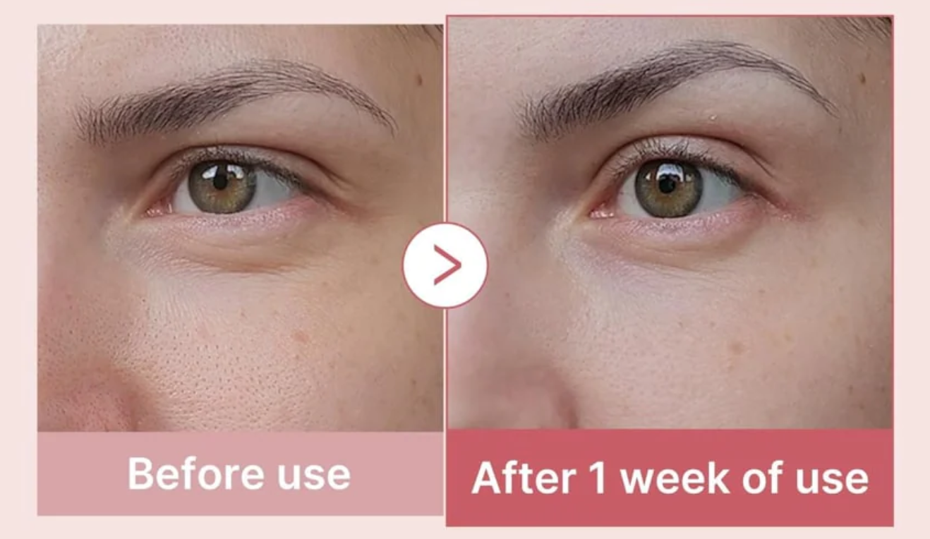 Eye Care