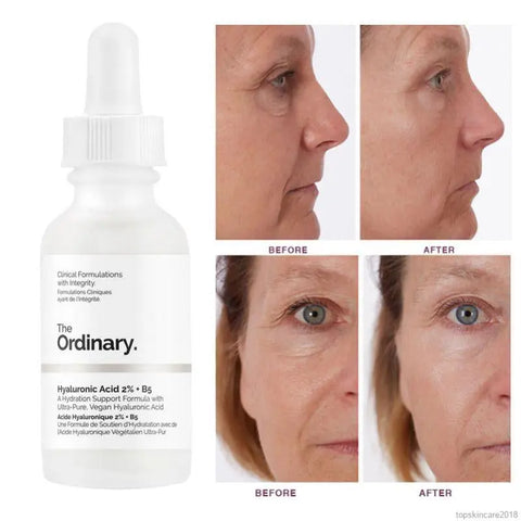 The Ordinary - Hyaluronic Acid 2% + B5 30ml Ordinary