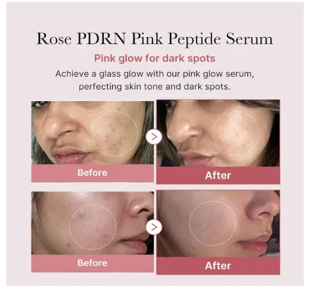 medicube PDRN Pink Peptide Serum, Pink glow serum, Peptide, Niacinamide, Hydrating & Moisturizing & Firming, Uneven Skin Tone, Korean Skincare | 1.01 fl.oz. (1.01 fl.oz., Rose PDRN (Vegan)) Clari.com.pk
