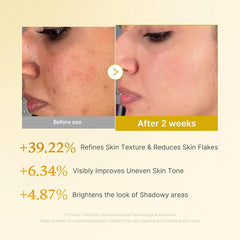 medicube Kojic Acid Turmeric Resurfacing Toner for Face & Body 250ml