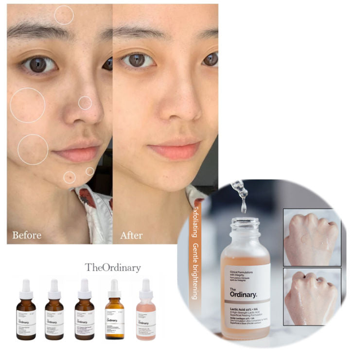 The Ordinary - Lactic Acid 10% + HA 30mL Clari