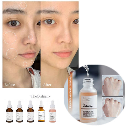 The Ordinary - Lactic Acid 10% + HA 30mL Clari