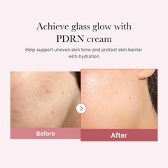 Medicube PDRN Pink Hyaluronic Moisturizing Cream