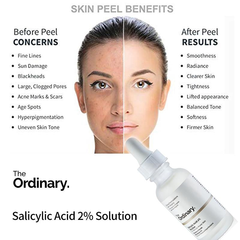 The Ordinary - Salicylic Acid 2% Solution Clari