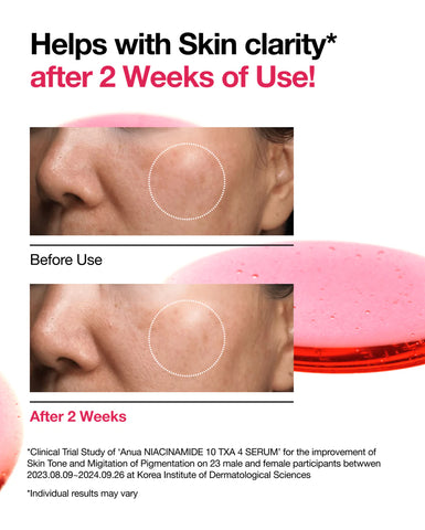 ANUA NIACINAMIDE 10%+TXA 4% Serum NEW