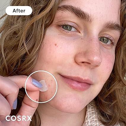 COSRX - Acne Pimple Master Patch (24 Patches) | Buy in Pakistan - Clari