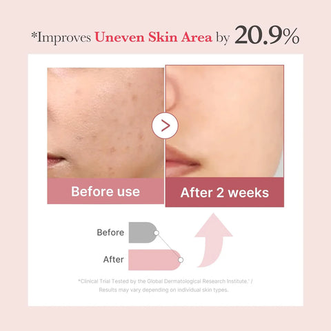 Before and after skin improvement showing reduced unevenness with a 20.9% improvement rate.