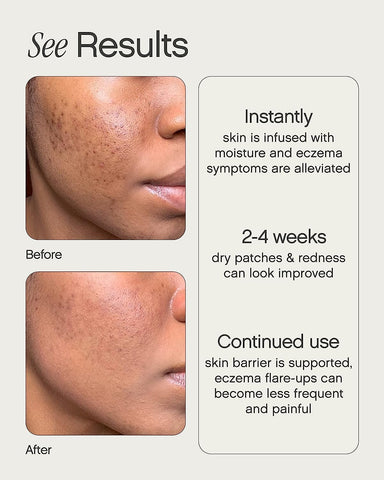 Topicals Like Butter Moisturizer for Dry, Sensitive & Eczema-Prone Skin - Soothing Instant Moisturizer and Eczema Relief for Face and Body, Skin Hydration