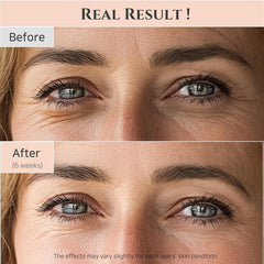 Beauty of Joseon - Revive Eye Serum Ginseng + Retinal - 30Ml | Buy in Pakistan - Clari