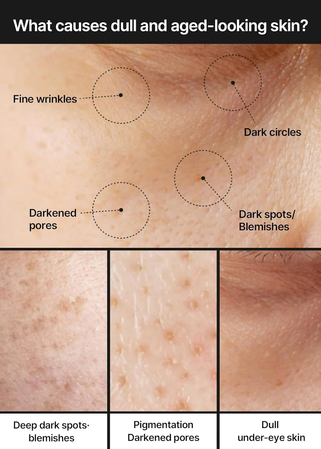 Close-up images of skin showing common signs of dull and aged-looking skin, including fine wrinkles, dark circles, darkened pores, dark spots, blemishes, pigmentation, deep dark spots, and dull under-eye skin, with dotted circles pointing to each concern.