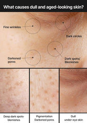 Close-up images of skin showing common signs of dull and aged-looking skin, including fine wrinkles, dark circles, darkened pores, dark spots, blemishes, pigmentation, deep dark spots, and dull under-eye skin, with dotted circles pointing to each concern.