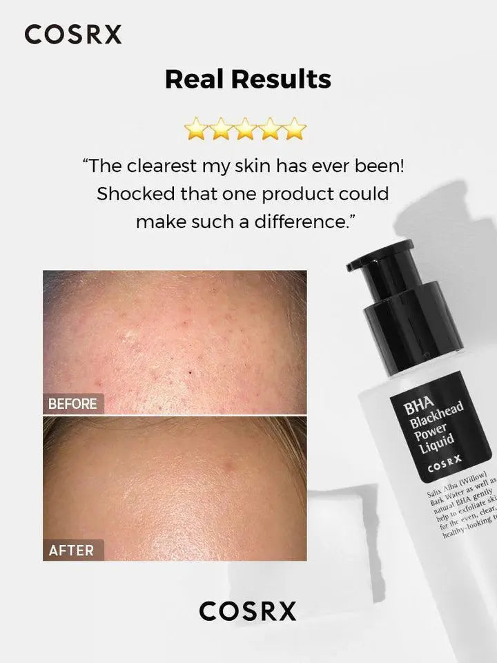 COSRX BHA Blackhead Power Liquid 100ml | Best Korean Exfoliating Toner for Blackheads, Clogged Pores & Acne-Prone Skin in Pakistan Clari