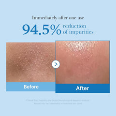 Medicube Zero Pore Blackhead Deep Cleansing Oil 205ml Expiry 05 - 2027