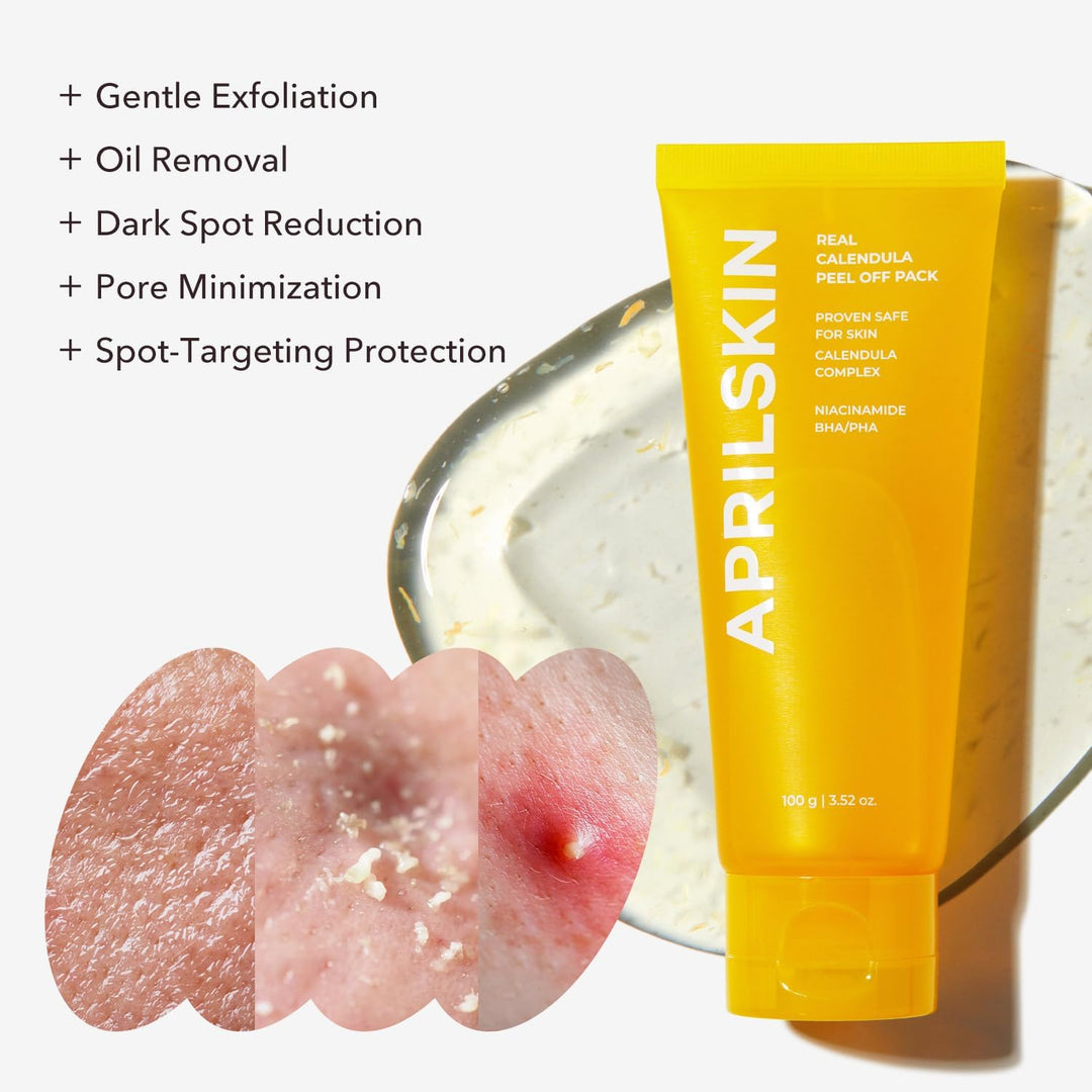 Aprilskin Real Calendula Peel Off Pack Facial Mask - 100g(Exp:2026/10)