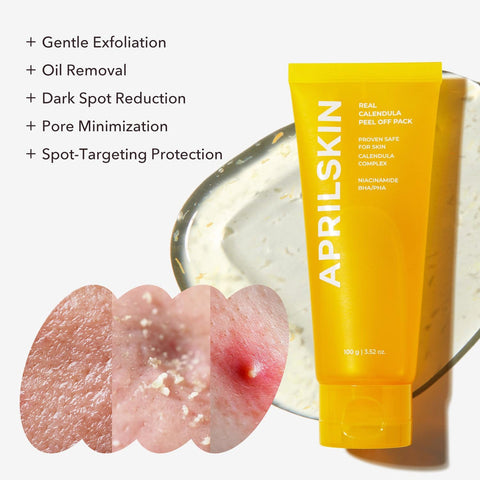 Aprilskin Real Calendula Peel Off Pack Facial Mask - 100g(Exp:2026/10)