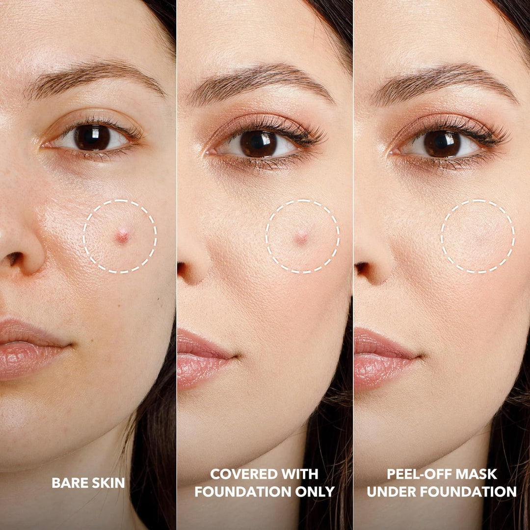 Aprilskin Real Calendula Peel Off Pack Facial Mask - 100g(Exp:2026/10)